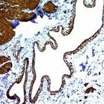 Actin, Smooth Muscle (Leiomyosarcoma Marker) Antibody in Immunohistochemistry (Paraffin) (IHC (P))