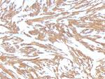 Actin, Smooth Muscle (Leiomyosarcoma Marker) Antibody in Immunohistochemistry (Paraffin) (IHC (P))