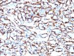 Actin, Smooth Muscle (Leiomyosarcoma Marker) Antibody in Immunohistochemistry (Paraffin) (IHC (P))