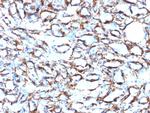 Actin, Smooth Muscle (Leiomyosarcoma Marker) Antibody in Immunohistochemistry (Paraffin) (IHC (P))