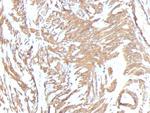 Actin, Smooth Muscle (Leiomyosarcoma Marker) Antibody in Immunohistochemistry (Paraffin) (IHC (P))