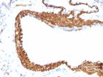 Actin, Smooth Muscle (Leiomyosarcoma Marker) Antibody in Immunohistochemistry (Paraffin) (IHC (P))