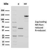 Actin, Smooth Muscle (Leiomyosarcoma Marker) Antibody in SDS-PAGE (SDS-PAGE)