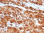 Actin, Smooth Muscle Antibody in Immunohistochemistry (Paraffin) (IHC (P))