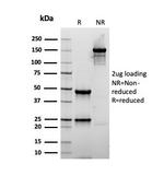 Actin, Smooth Muscle Antibody in SDS-PAGE (SDS-PAGE)