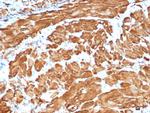 Actin, Smooth Muscle (Leiomyosarcoma Marker) Antibody in Immunohistochemistry (Paraffin) (IHC (P))