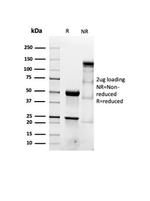 Actin, Smooth Muscle (Leiomyosarcoma Marker) Antibody in SDS-PAGE (SDS-PAGE)