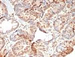 Rb1 (Tumor Suppressor Protein) Antibody in Immunohistochemistry (Paraffin) (IHC (P))