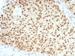 Rb1 (Tumor Suppressor Protein) Antibody in Immunohistochemistry (Paraffin) (IHC (P))