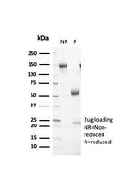 Rb1 (Tumor Suppressor Protein) Antibody in SDS-PAGE (SDS-PAGE)