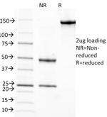 Retinol Binding Protein-1 (RBP1) Antibody in SDS-PAGE (SDS-PAGE)