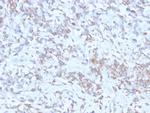 Retinol Binding Protein-1 (RBP1) Antibody in Immunohistochemistry (Paraffin) (IHC (P))