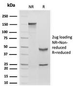 Retinol Binding Protein-1 (RBP1) Antibody in SDS-PAGE (SDS-PAGE)