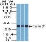 Cyclin D1 (G1-Cyclin and Mantle Cell Marker) Antibody in Western Blot (WB)