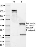 Cyclin D1 (G1-Cyclin and Mantle Cell Marker) Antibody in SDS-PAGE (SDS-PAGE)