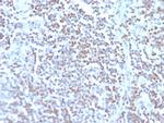 Cyclin D1 (G1-Cyclin and Mantle Cell Lymphoma Marker) Antibody in Immunohistochemistry (Paraffin) (IHC (P))