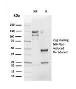 Cyclin D1 (G1-Cyclin and Mantle Cell Lymphoma Marker) Antibody in SDS-PAGE (SDS-PAGE)