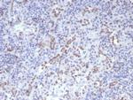 Cyclin D1 (G1-Cyclin and Mantle Cell Lymphoma Marker) Antibody in Immunohistochemistry (Paraffin) (IHC (P))