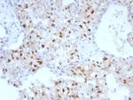 Cyclin D1 (G1-Cyclin and Mantle Cell Lymphoma Marker) Antibody in Immunohistochemistry (Paraffin) (IHC (P))