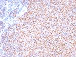 Cyclin D1 (G1-Cyclin and Mantle Cell Marker) Antibody in Immunohistochemistry (Paraffin) (IHC (P))