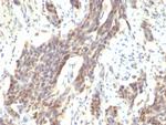 Cyclin D1 (G1-Cyclin and Mantle Cell Marker) Antibody in Immunohistochemistry (Paraffin) (IHC (P))