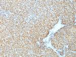 Cyclin D1 (G1-Cyclin and Mantle Cell Marker) Antibody in Immunohistochemistry (Paraffin) (IHC (P))