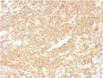 Cyclin D1 (G1-Cyclin and Mantle Cell Lymphoma Marker) Antibody in Immunohistochemistry (Paraffin) (IHC (P))