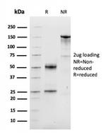 Cyclin D1 (G1-Cyclin and Mantle Cell Lymphoma Marker) Antibody in SDS-PAGE (SDS-PAGE)