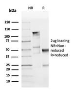 Cyclin D1 Antibody in SDS-PAGE (SDS-PAGE)