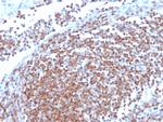 Cyclin D1 Antibody in Immunohistochemistry (Paraffin) (IHC (P))