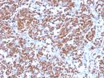 Cyclin D1 Antibody in Immunohistochemistry (Paraffin) (IHC (P))