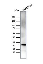 RBP4/Retinol Binding Protein 4 Antibody in Western Blot (WB)