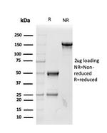 RBP4/Retinol Binding Protein 4 Antibody in SDS-PAGE (SDS-PAGE)