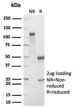 RBP4/Retinol Binding Protein 4 Antibody in SDS-PAGE (SDS-PAGE)