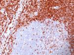 Bcl-2 (Apoptosis and Follicular Lymphoma Marker) Antibody in Immunohistochemistry (Paraffin) (IHC (P))