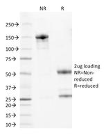 Bcl-2 (Apoptosis and Follicular Lymphoma Marker) Antibody in SDS-PAGE (SDS-PAGE)