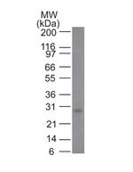 Bcl-2 (Apoptosis and Follicular Lymphoma Marker) Antibody in Western Blot (WB)