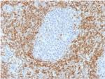 Bcl-2 Antibody in Immunohistochemistry (Paraffin) (IHC (P))