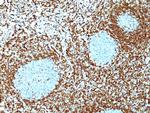 Bcl-2 (Apoptosis and Follicular Lymphoma Marker) Antibody in Immunohistochemistry (Paraffin) (IHC (P))