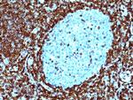 Bcl-2 (Apoptosis and Follicular Lymphoma Marker) Antibody in Immunohistochemistry (Paraffin) (IHC (P))