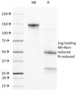 Bcl-2 (Apoptosis and Follicular Lymphoma Marker) Antibody in SDS-PAGE (SDS-PAGE)