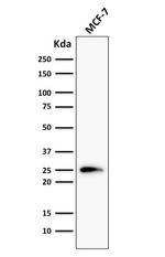 Bcl-2 (Apoptosis and Follicular Lymphoma Marker) Antibody in Western Blot (WB)