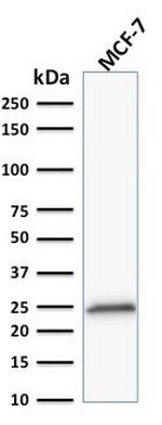 Bcl-2 (Apoptosis and Follicular Lymphoma Marker) Antibody in Western Blot (WB)