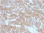 Bcl-2 (Apoptosis and Follicular Lymphoma Marker) Antibody in Immunohistochemistry (Paraffin) (IHC (P))