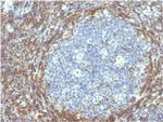 Bcl-2 (Apoptosis and Follicular Lymphoma Marker) Antibody in Immunohistochemistry (Paraffin) (IHC (P))