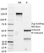 Bcl-2 (Apoptosis and Follicular Lymphoma Marker) Antibody in SDS-PAGE (SDS-PAGE)