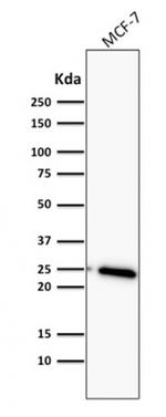 Bcl-2 (Apoptosis and Follicular Lymphoma Marker) Antibody in Western Blot (WB)