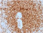 Bcl-2 Antibody in Immunohistochemistry (Paraffin) (IHC (P))