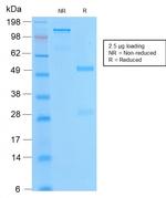 Bcl-2 Antibody in SDS-PAGE (SDS-PAGE)