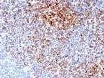 Bcl-2 Antibody in Immunohistochemistry (Paraffin) (IHC (P))